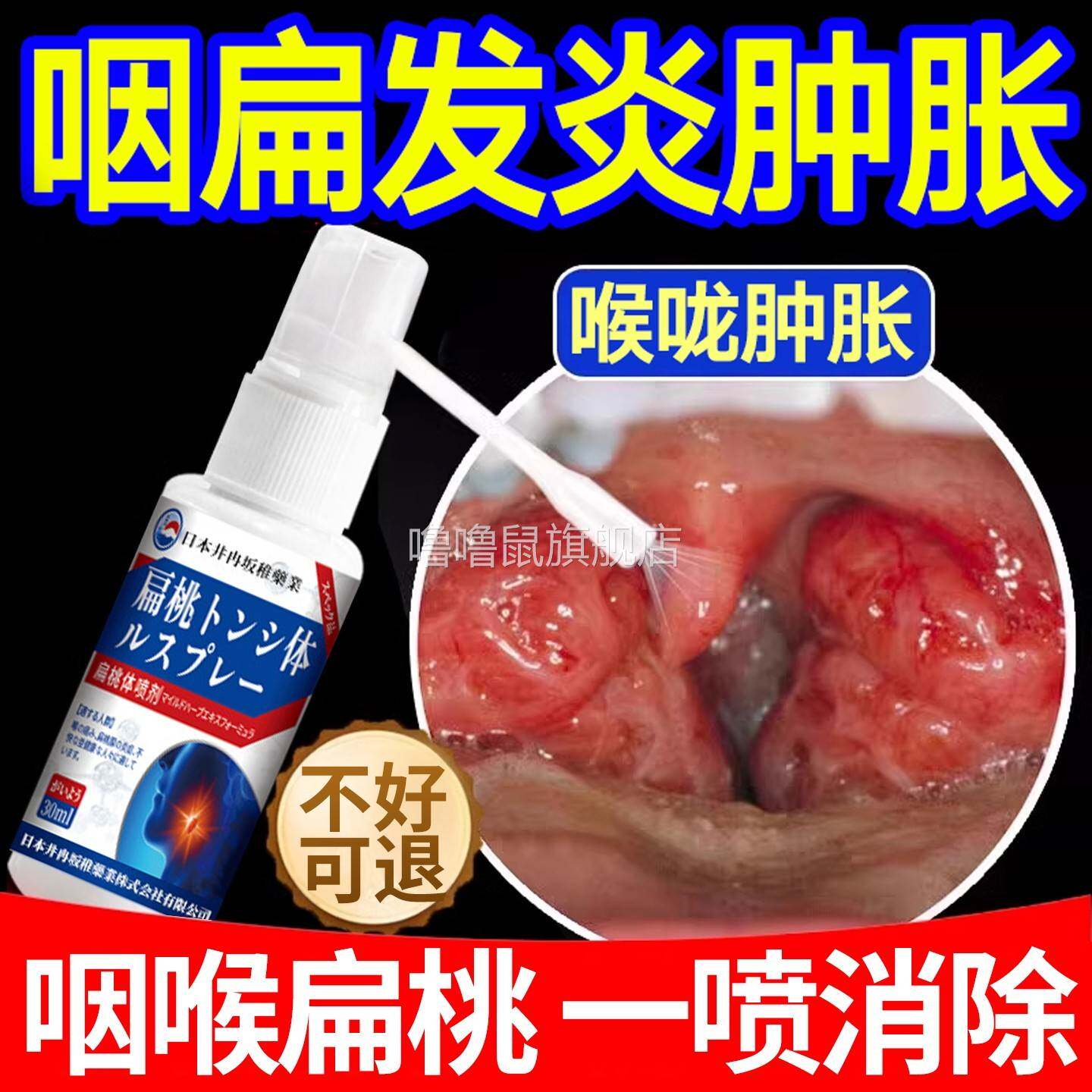 噜噜鼠正品日本进口扁桃体结石去除工具咽喉喉咙肿痛扁桃体发炎药