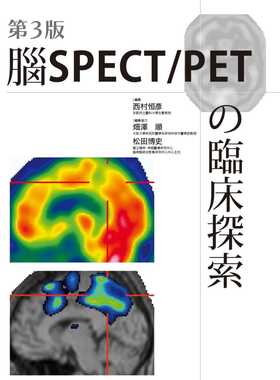 预售正版 港台原版 松田博史脑SPECT/PETの临床探索(第3版)枫书坊进口原版书 健康类原版书