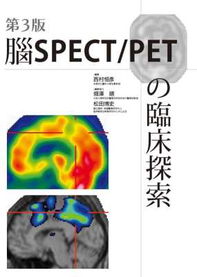 预售正版 港台原版 松田博史脑SPECT/PETの临床探索(第3版)枫书坊进口原版书 健康类原版书