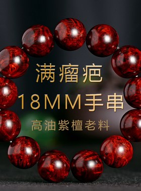满瘤疤炫纹瘿子佛珠男款