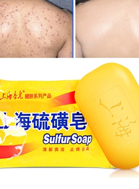 85g Shanghai Sulfur Soap Oil-Control Acne 身体磨砂膏soap