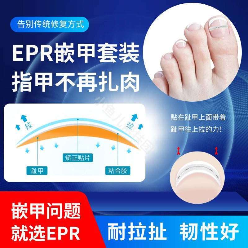 修脚专用EPR矫正钢丝矫正器脚美甲/修甲套装