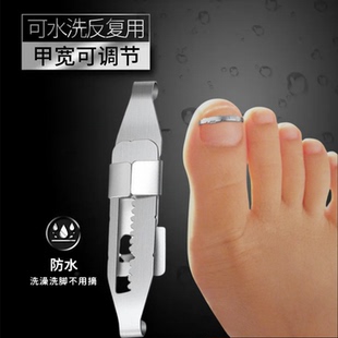正甲扣脚趾甲沟专用不锈钢可调节嵌甲矫正器贴片避免脚趾甲长肉里
