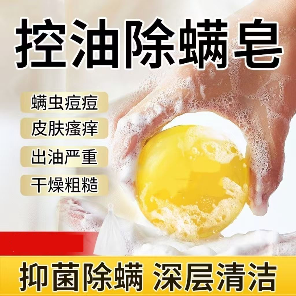 硫磺止痒润肤皂邹润安硫磺皂抑菌洗脸清洁皂沐浴皂全身洗手除螨