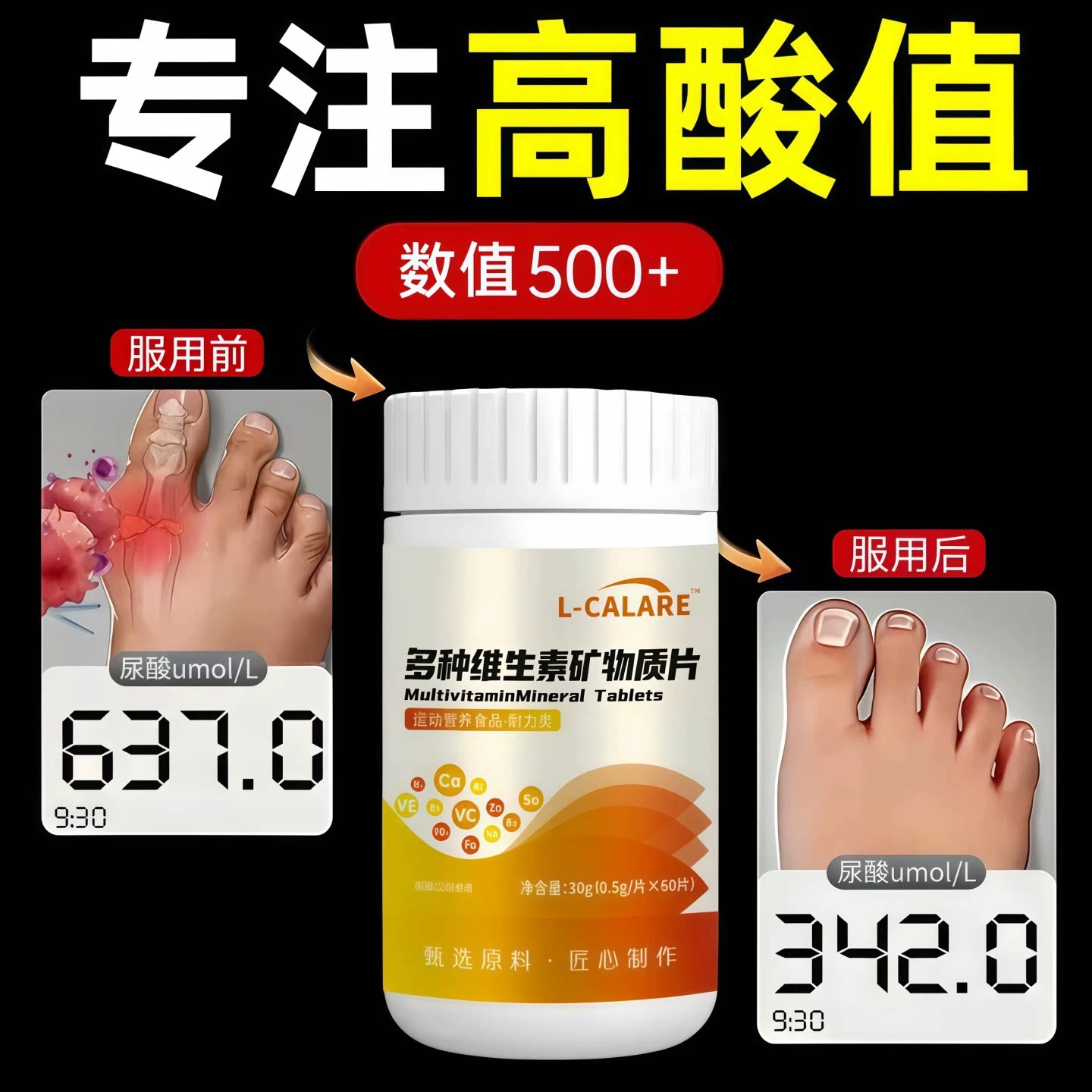 仲芙子消酸片尿酸调理关节呵护