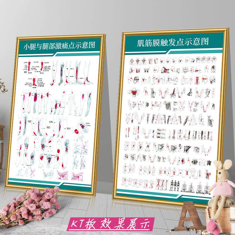 肌筋膜疼痛触发点挂图人体激痛点示意图中医院医学海报宣传画墙贴