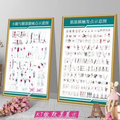 肌筋膜疼痛触发点挂图人体激痛点示意图中医院医学海报宣传画墙贴