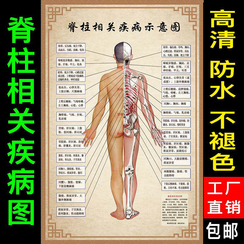 脊柱相关疾病人体经络穴位图大挂图美容院中医养生图片宣传画海报