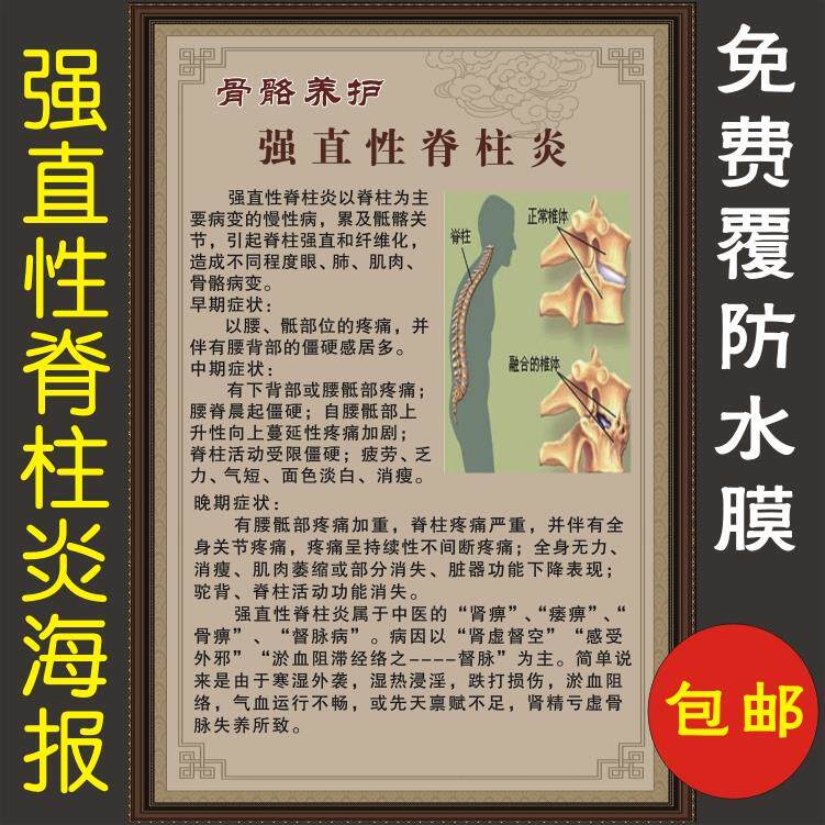 中医养生挂图医院骨科海报宣传什么是强直性脊柱炎及症状颈椎腰椎