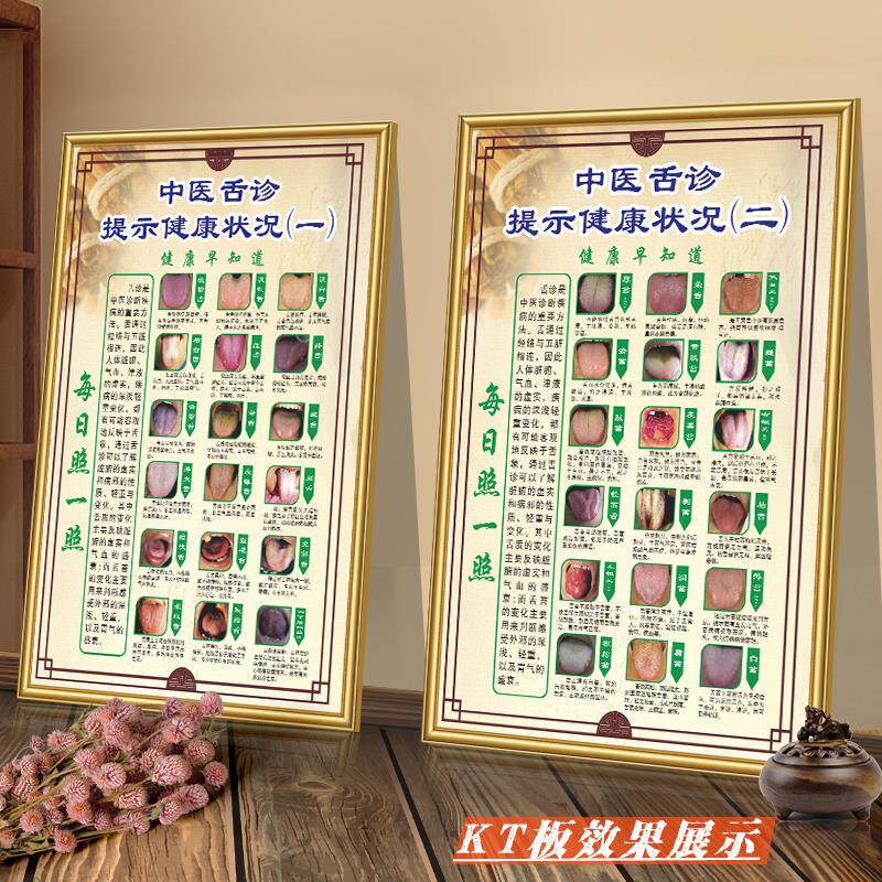 舌诊健康状况对照表中医理疗口腔保健医院挂图海报贴画宣传墙贴L