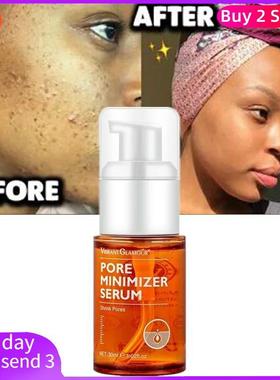 Salicylic Acid Face Serum Shrink Pore Moisturizing Whitening