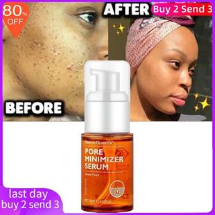 Salicylic Acid Face Serum Shrink Pore Moisturizing Whitening