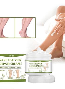Varicose Veins Cream Varicose Vein Treatment Cream For Legs