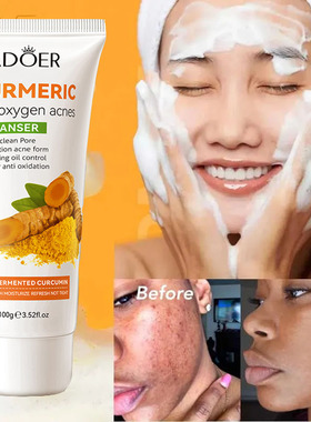 turmeric face cleanser wash gel blackhead acne spot洗面奶乳