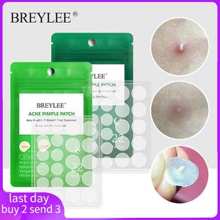 Acne Pimple Patch Stickers Acne Treatment Pimple Remover To