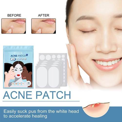 80pcs/set Acne Patches Large Size Hydrocolloid Acne Invisibl