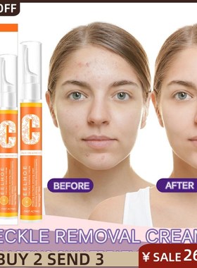 Vitamin C Freckle Removal pen VC霜面部淡化黑色素笔 skin care