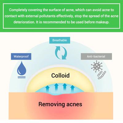 Acne Pimple Patch  Stickers Treatment Pimple Remover 痘痘贴