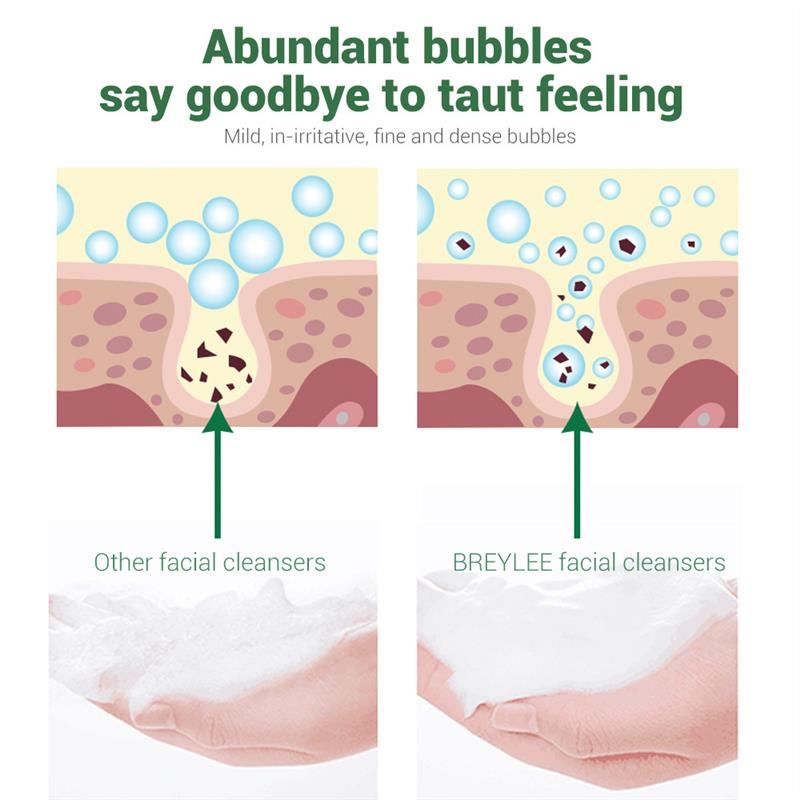 BREYLEE tea tree cleanser acne Treatment洗面奶洁面face wash