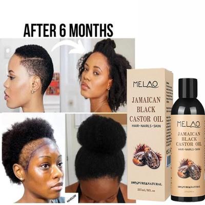 Jamaican Organic Black Castor Oil Hair Growth Scalp黑蓖麻油