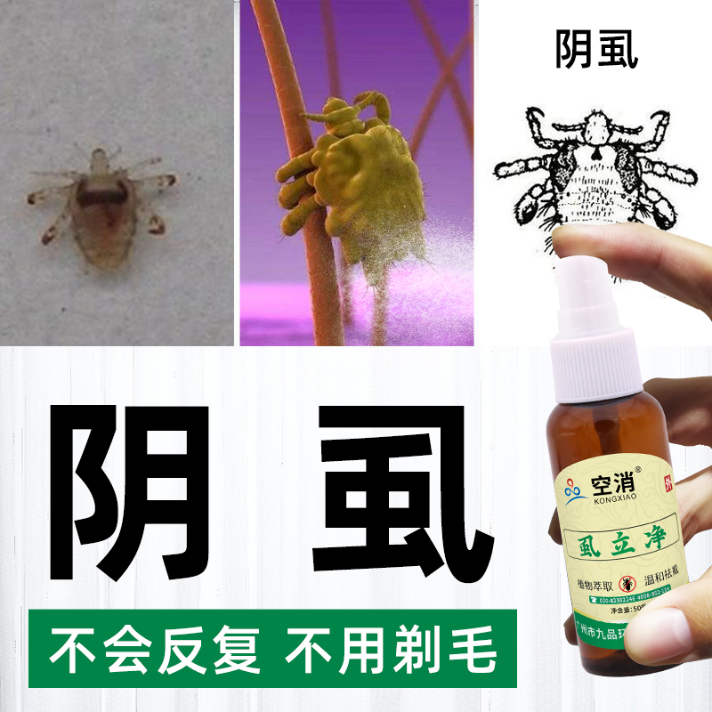 阴虱头虱立净 男女士灭除毛头虱卵虫虱子