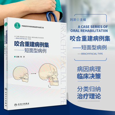咬合重建病例集短面型病例
