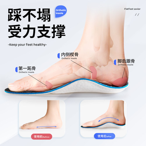 扁平足矫正鞋垫男女平底足专用减震足弓支撑鞋垫偏平足外翻矫形器