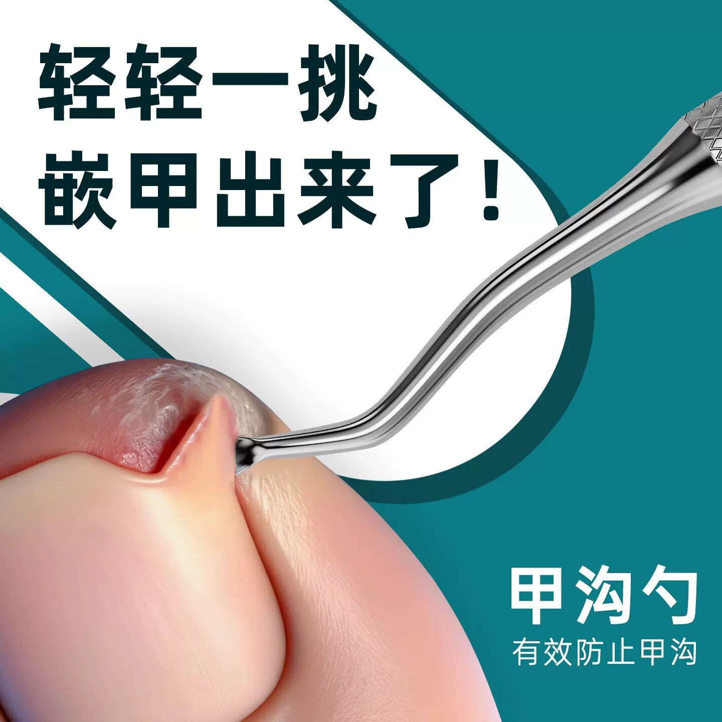 甲沟嵌甲专用剔甲器甲沟勺脚趾甲缝清理修脚刀工具指甲剪刀套装炎