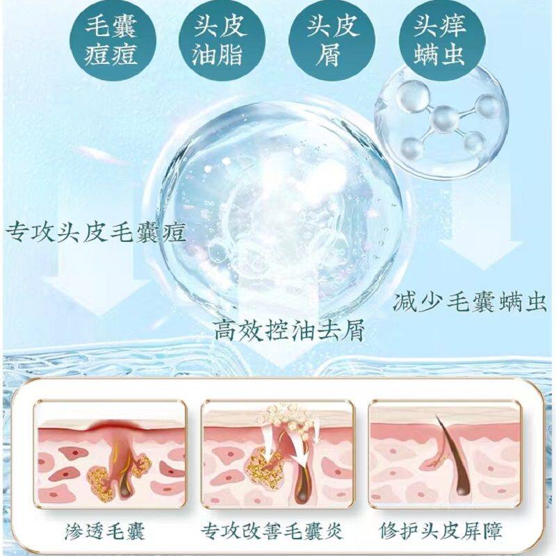 理发店头皮排毒毛囊深层清洁液洗发水去屑止痒控油烫染修复精华液