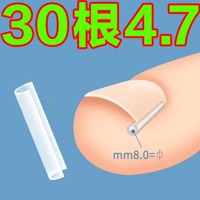 速发甲沟神片指甲矫正器嵌甲炎隔离填充垫器脚趾甲往肉里长纠正甲