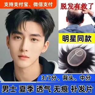 速发刘发顶士假发前额旋无痕头男补发片遮秃顶白发短发真海真人造