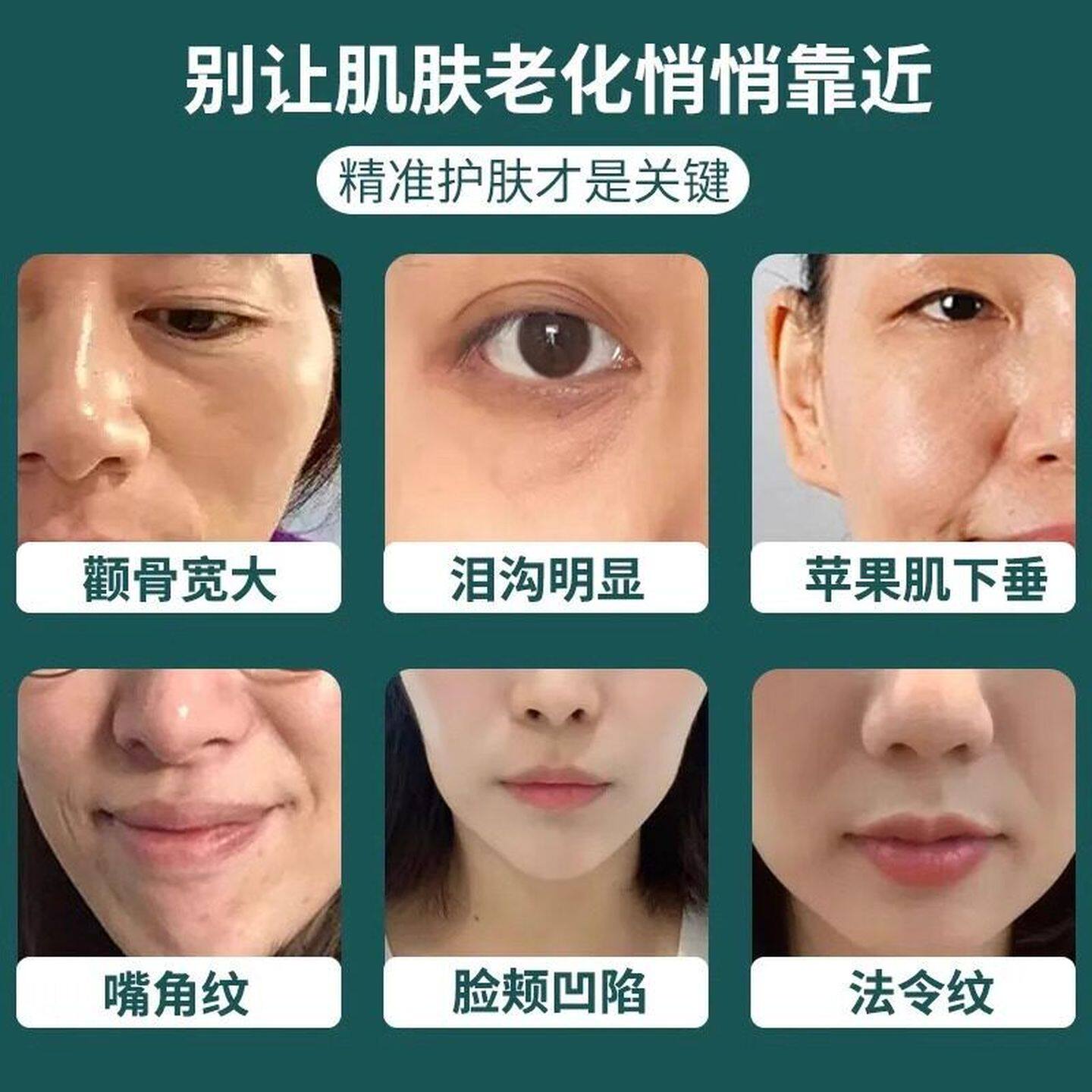 skik面部丰盈精华液额提拉紧致面部眼周眼窝卧蚕淡纹官方正品