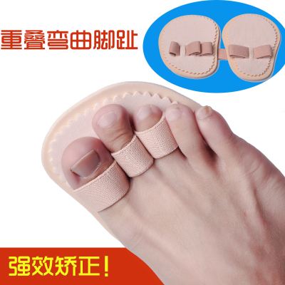 儿童弯曲拇外翻分趾器