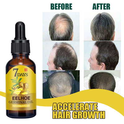 Ginger Hair Growth Products Fast Growing Hair Essential Oil