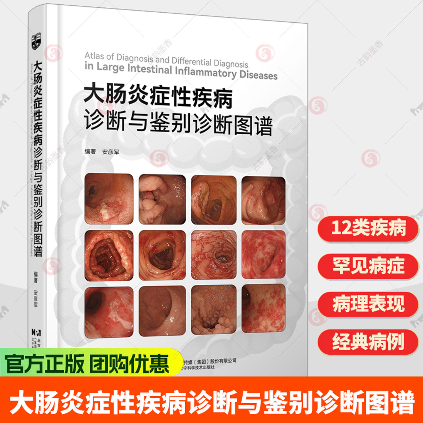 大肠炎症性疾病诊断与鉴别诊断图谱 安彦军 临床医学消化科常见疾病诊断治疗教程书籍 肠胃疾病内镜操作技巧大全书籍