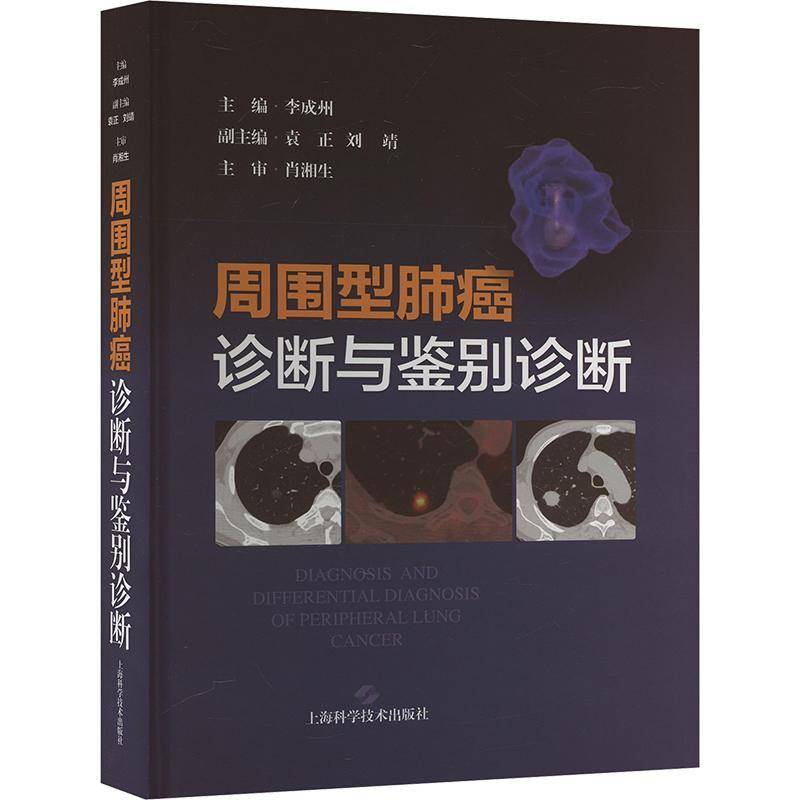 周围型肺癌诊断与鉴别诊断李成州 医药卫生书籍