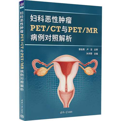 妇科恶性PET/CT与PET/MR病例对照解析孙洪赞 医药卫生书籍