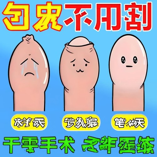包皮不用割自动脱落修覆收缩矫正器包茎过长隐形阻覆环外翻器