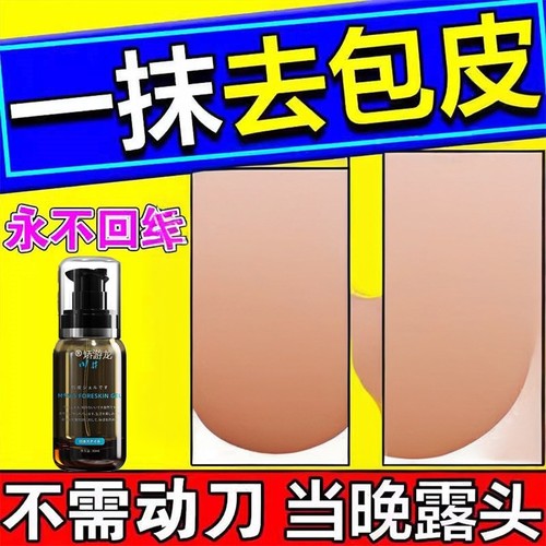 包皮不用割自动脱落修覆收缩矫正器包茎过长隐形阻覆环外翻器