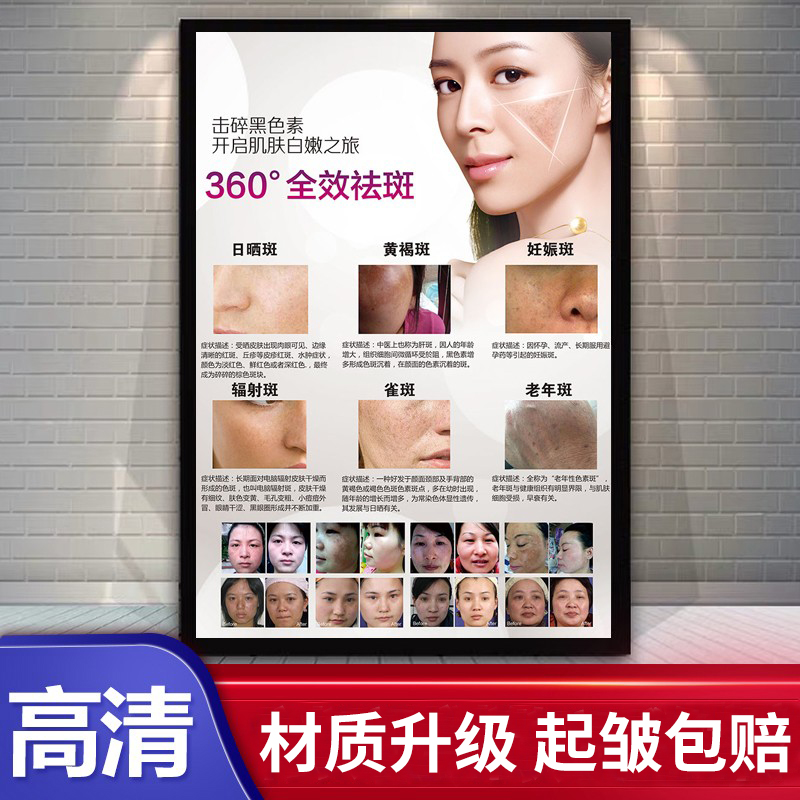 纹绣祛痘去斑海报宣传画