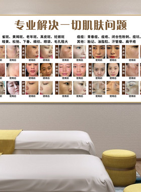 祛斑祛痘海报美容院广告展示牌