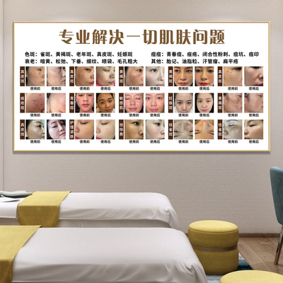 祛斑祛痘海报美容院广告展示牌