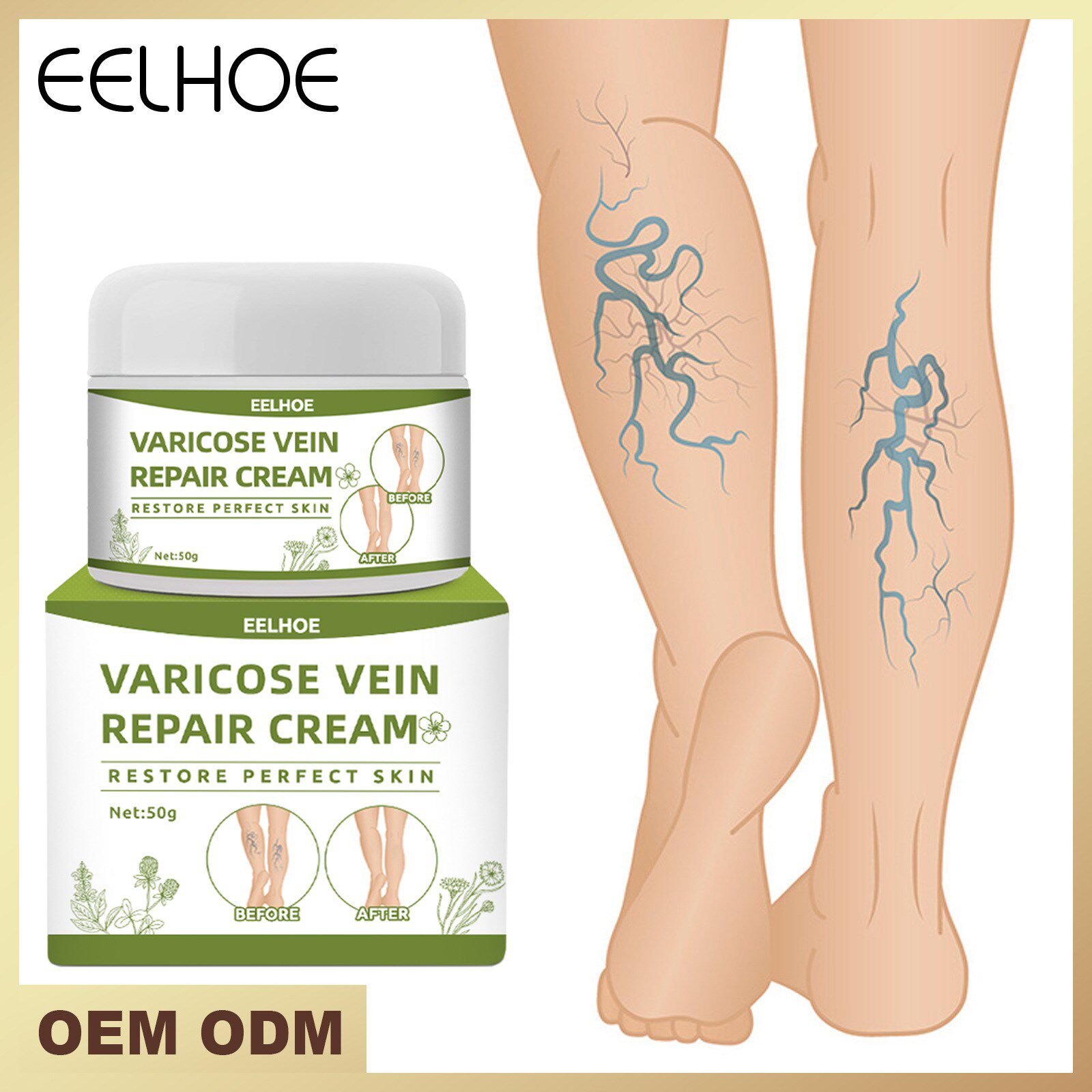 Varicose Veins Cream Varicose Vein Treatment Cream For Legs