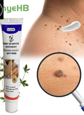 2Warts Remover Ointment Wart Treatment Cream Skin Tag Remove