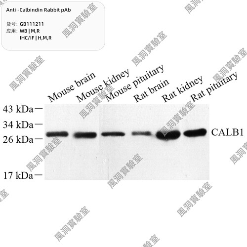 Anti -Calbindin Rabbit pAb，抗钙粘蛋白兔 pAb，100 μL