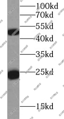 FineTest 二抗  未标记二抗，兔抗-人 IgG 抗体 ，适用ELISA/WB