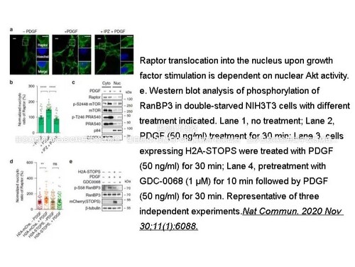 APExBIO高选择性Pan-AKT抑制剂，GDC-0068(RG7440)，Ipatasertib