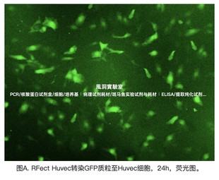 RFect Huvec质粒DNA转染试剂套装,高效转染脐静脉/肺动脉内皮细胞