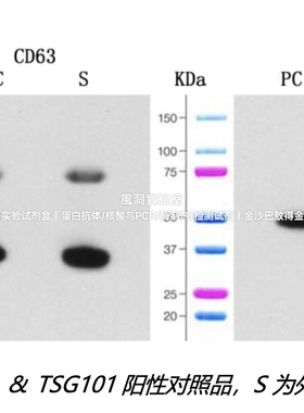 umibio®外泌体CD63&TSG101蛋白检测试剂盒,适用外泌体蛋白检测WB