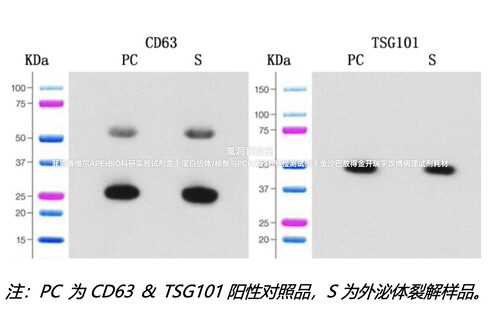 umibio®外泌体CD63&TSG101蛋白检测试剂盒,适用外泌体蛋白检测WB